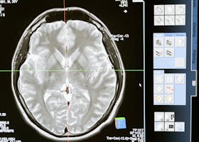 Intricate MRI brain scan displayed on a computer screen for medical analysis and diagnosis.